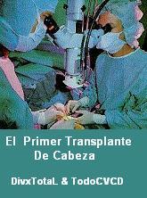 pelicula El Primer Transplante De Cabeza